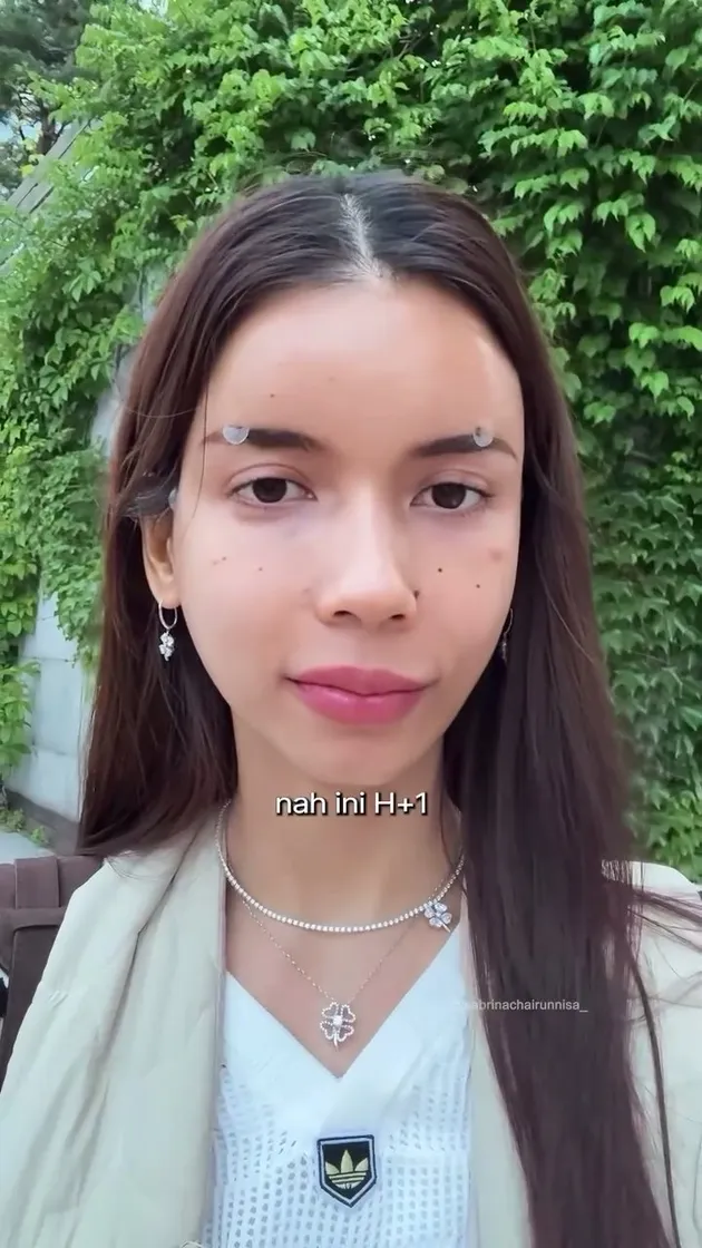 <nil>