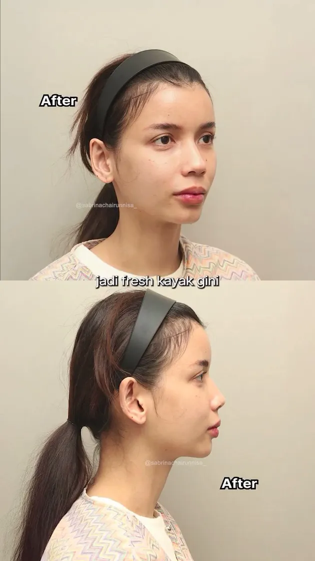 <nil>