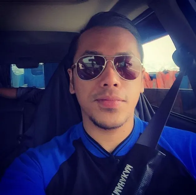 Sammy Simorangkir Operasi Plastik