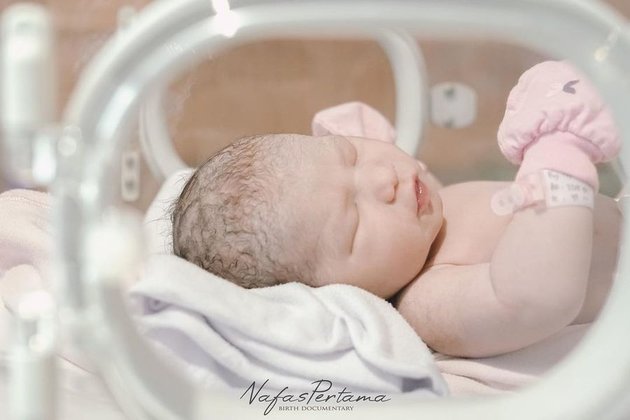 Once Thought to be a Fake Pregnancy, Photos of the Moment of the Birth of Rosiana Dewi and Handika Pratama's First Child - Handika Pratama Becomes an Alert Husband