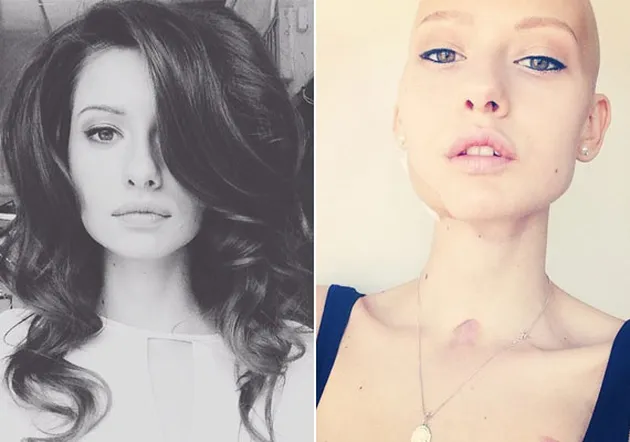 ELIZAVETA, MODEL CANTIK KEHILANGAN RAHANG YANG JADI 