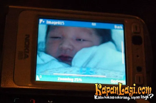 Eric Scada dan Lyra Virna