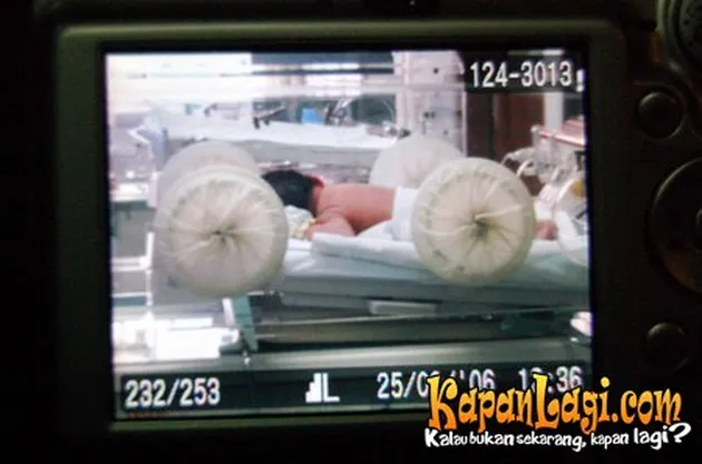 Eric Scada dan Lyra Virna