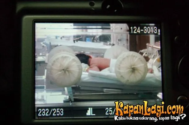 Eric Scada dan Lyra Virna