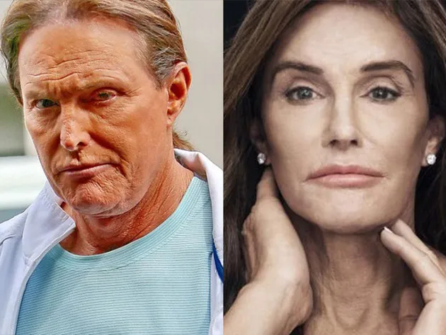 Foto Memalukan Caitlyn Jenner