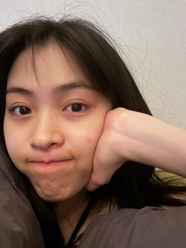 <nil>