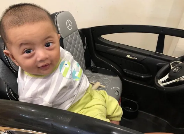 anak kembar Kadek Devi