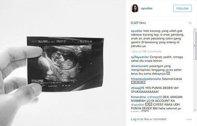 Baby Bump Ayudia Bing Slamet