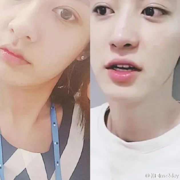 Chanyeol Park Yoora