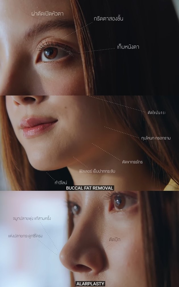 <nil>