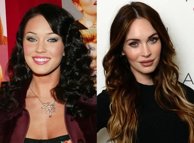 Seleb Yang Lakukan Lip Injections