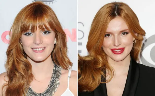 Seleb Yang Lakukan Lip Injections