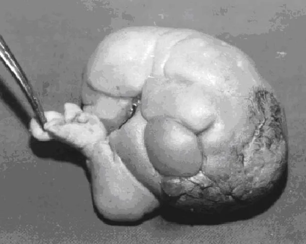 benda-benda mengerikan di tubuh manusia