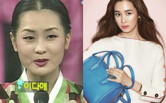FOTO: Bintang Korea Oplas Yang Cantiknya Paling Tampak ...