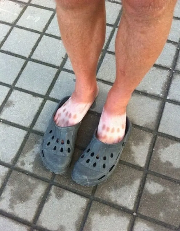 foto-foto kegilaan manusia saat musim panas