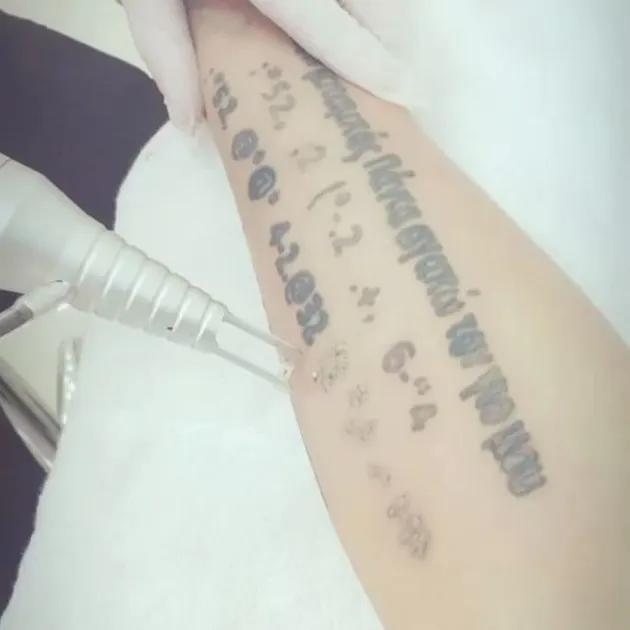Egi John Hapus Tato