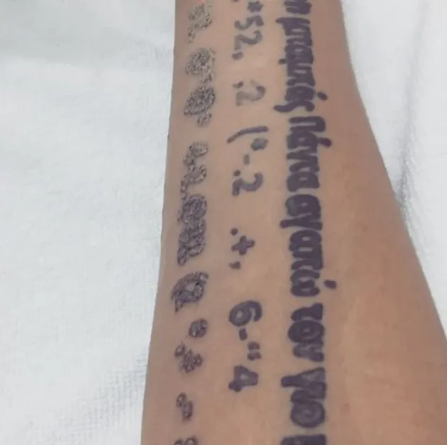 Egi John Hapus Tato