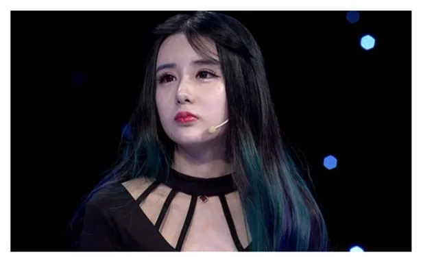 FOTO: GADIS CHINA 16 TAHUN LAKUKAN OPLAS, KINI MIRIP BOM 
