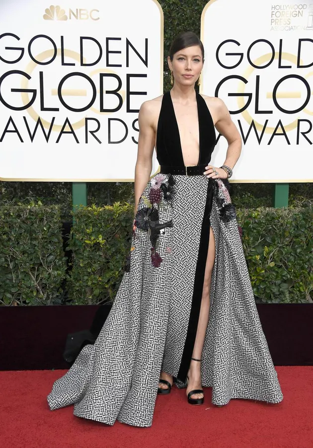 Worst Dressed Golden Globe 2017