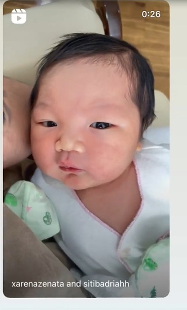 Photo of Cute Baby Xarena, Siti Badriah and Krisjiana's Child, the Chubby Cheek that Makes Mommy Stay Up All Night