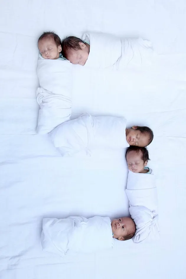 foto bayi kembar lima asal Cirebon, AIUEO