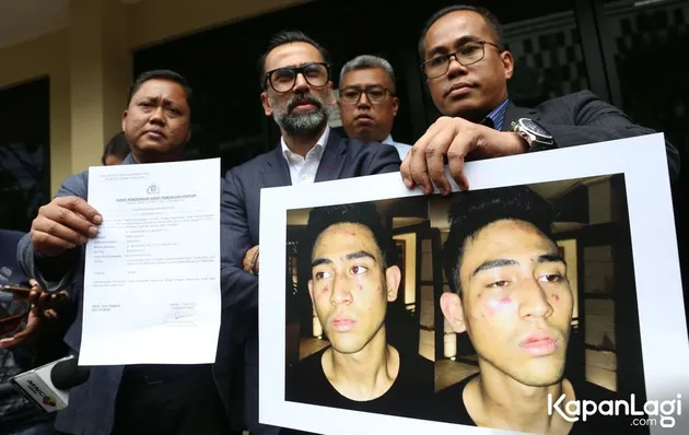 Saat ditemui di Propam Mabes Polri, Jakarta Selatan, Senin (17/07), Jeremy Thomas menceritakan soal kronologi insiden yang menimpa sang anak yakni Axel Matthew Thomas.