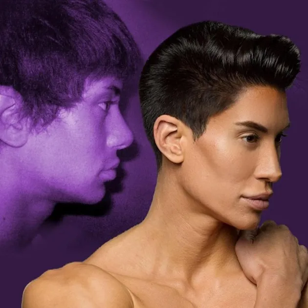 Justin Jedlica Human Ken Doll