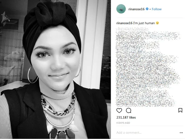 Rina Nose Lepas Hjab