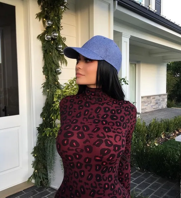 Kylie Jenner operasi plastik