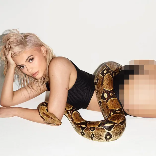 Kylie Jenner operasi plastik