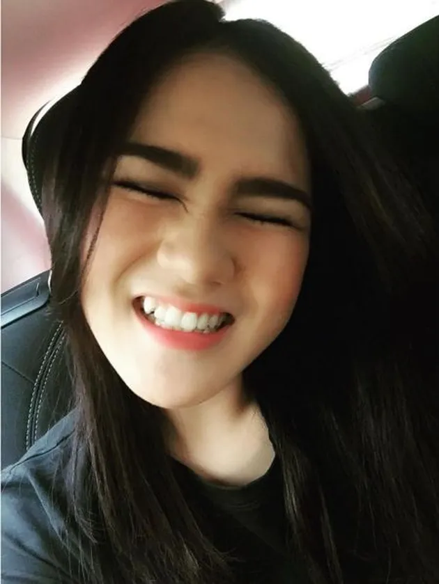 artis cantik, gingsul, artis indonesia, gigi gingsul