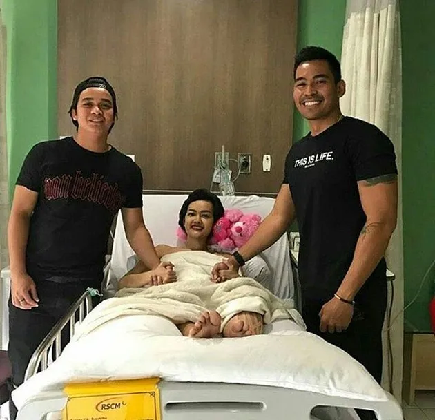 Kaki Julia Perez Bengkak