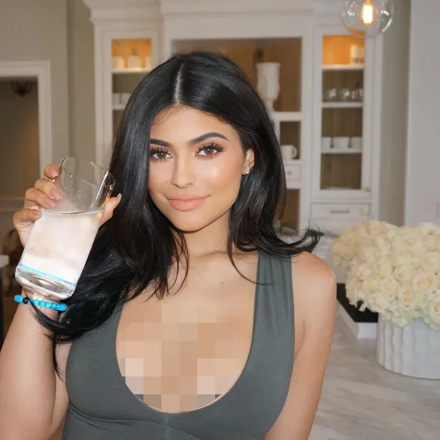 Kylie Jenner Implan Payudara
