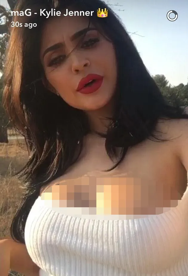 Kylie Jenner Implan Payudara
