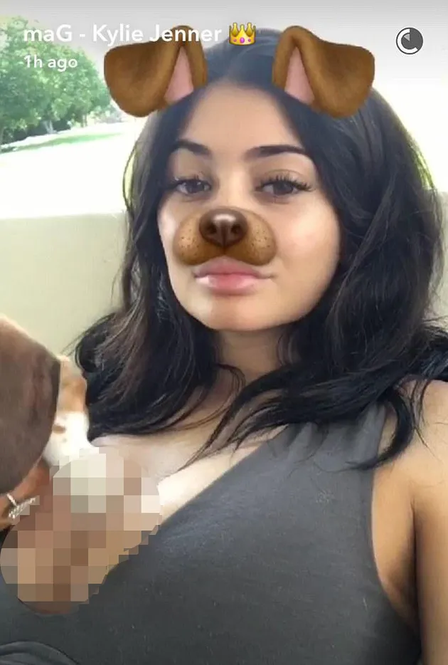 Kylie Jenner Implan Payudara