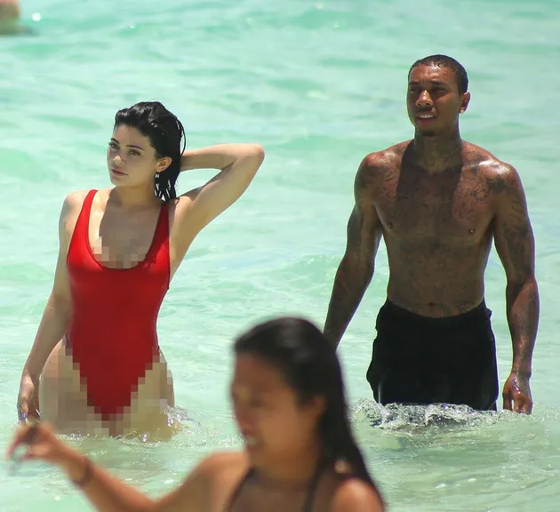 Kylie Jenner Implan Payudara
