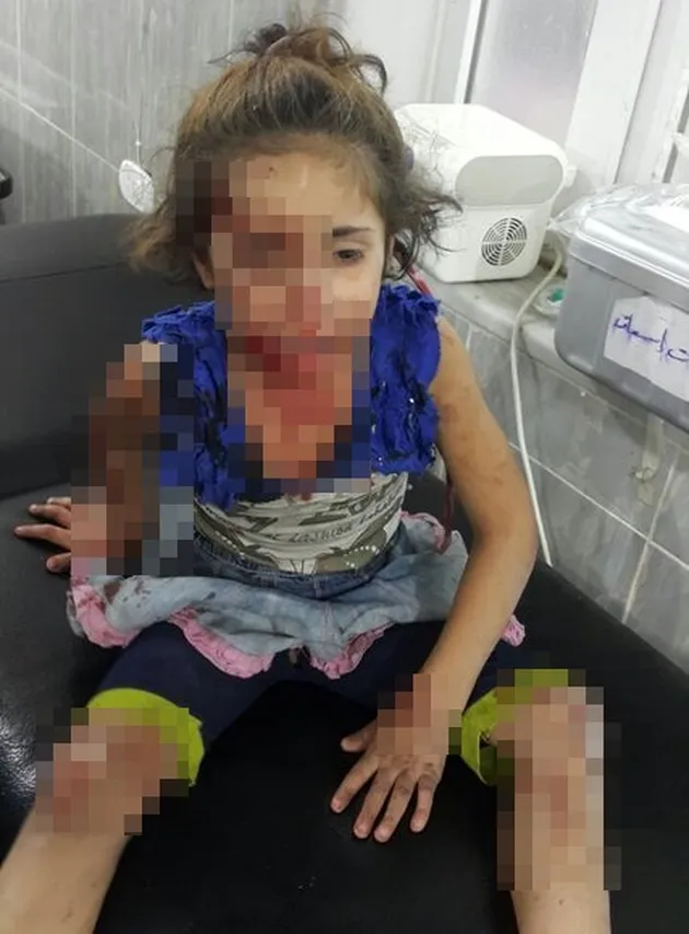 foto Omran Daqneesh bocah Suriah