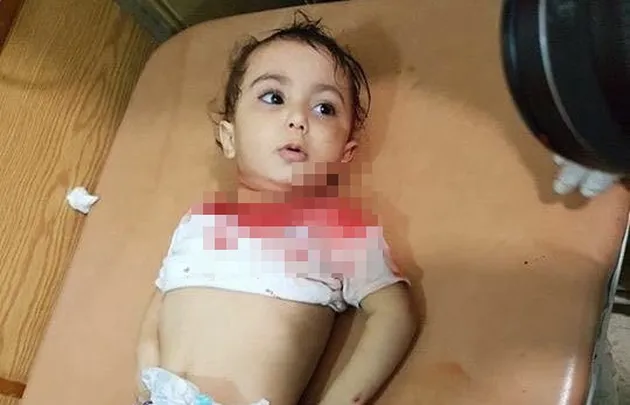foto Omran Daqneesh bocah Suriah