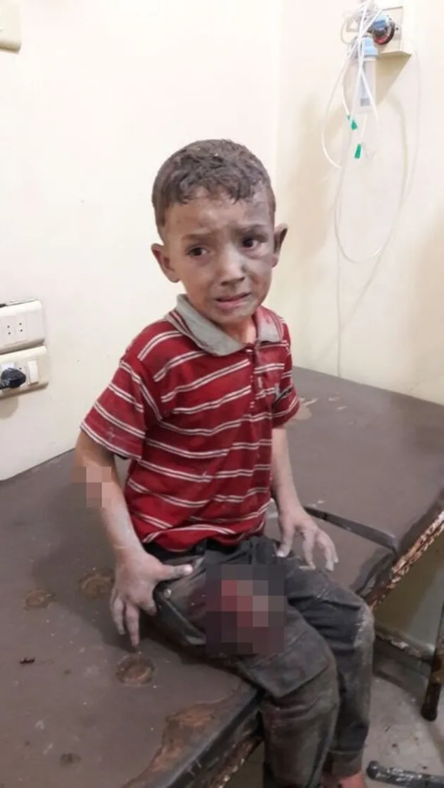 foto Omran Daqneesh bocah Suriah