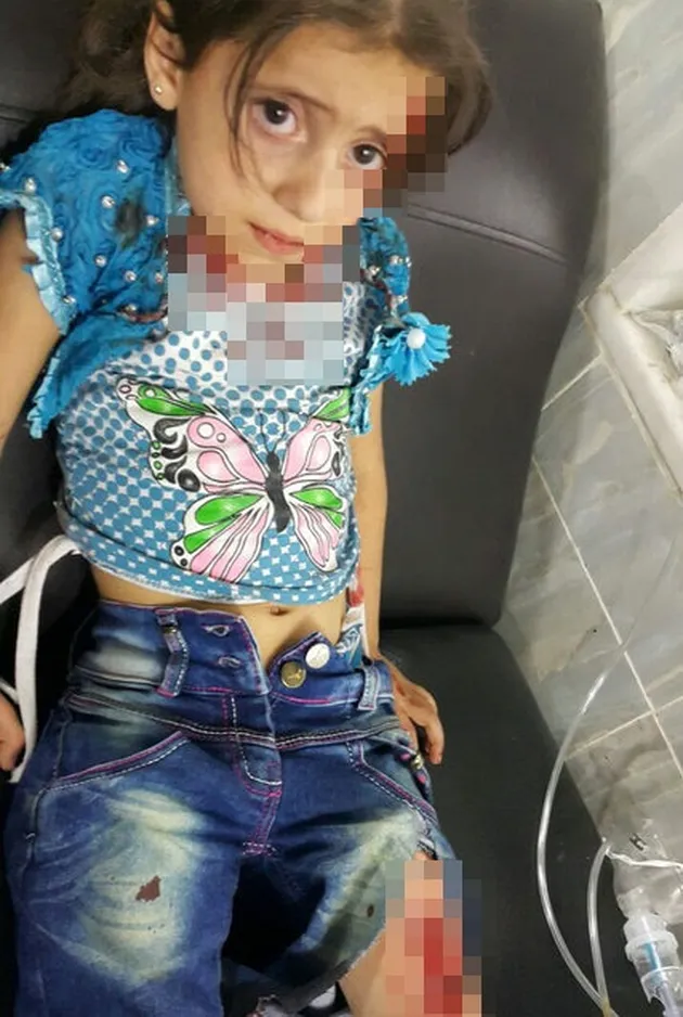 foto Omran Daqneesh bocah Suriah