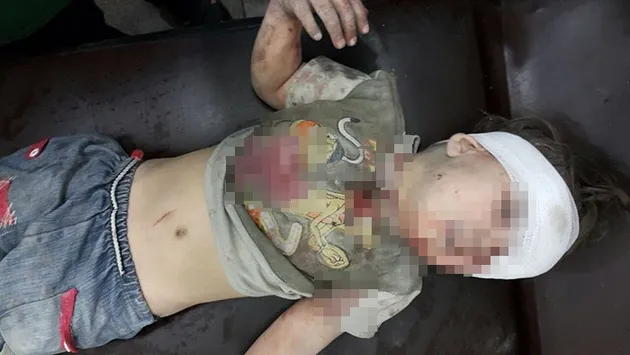 foto Omran Daqneesh bocah Suriah