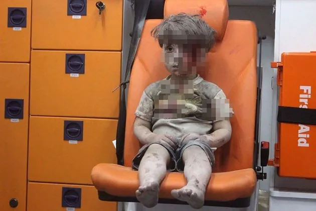 foto Omran Daqneesh bocah Suriah