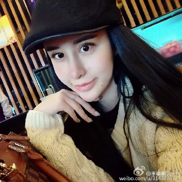 Lee Hee Danae operasi plastik jadi boneka barbie