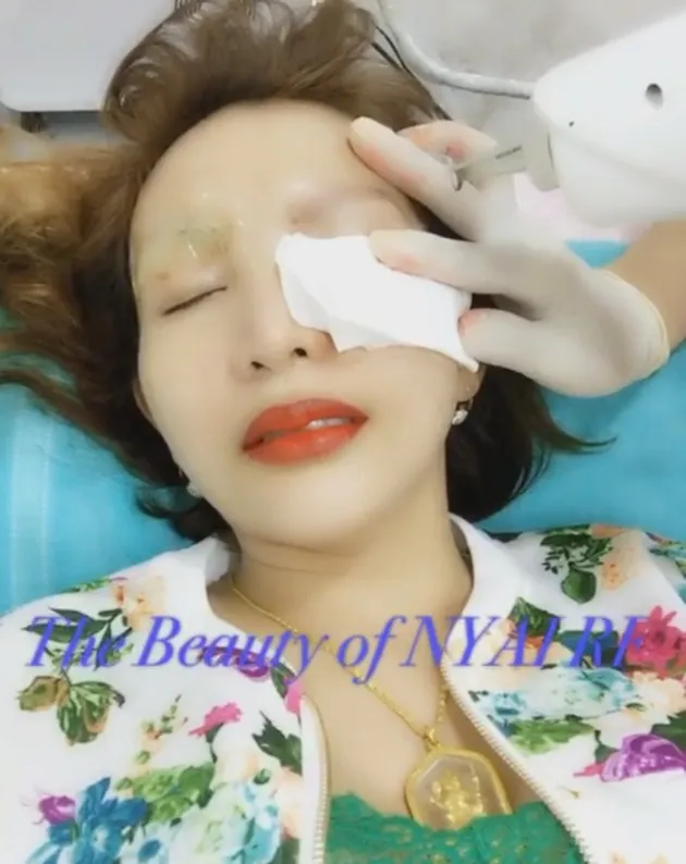 Perawatan Kecantikan Roro Fitria