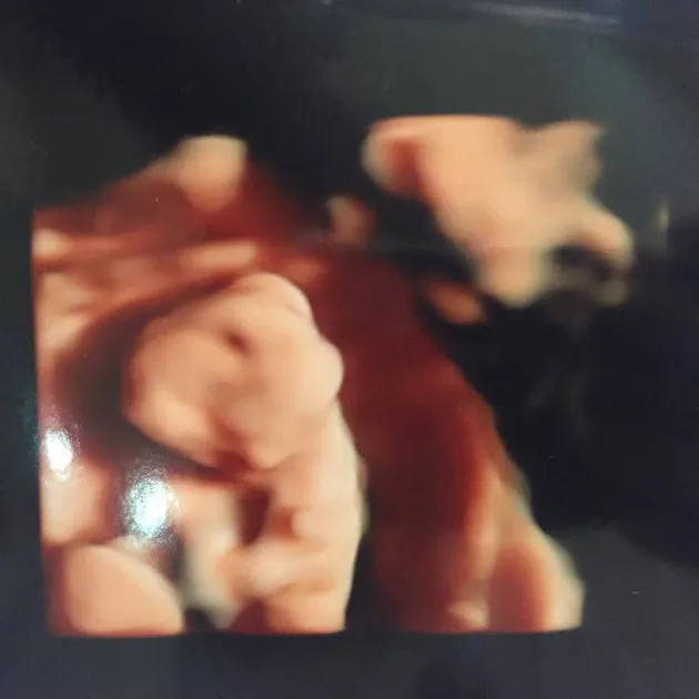 Ashanty Cantik Saat Hamil 