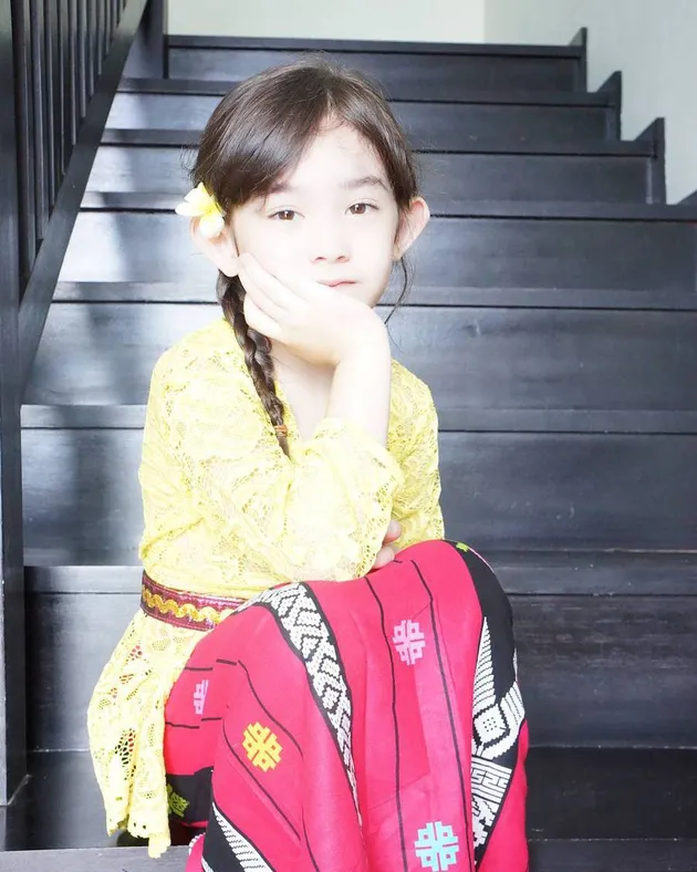Mikhaela anak nafa urbach