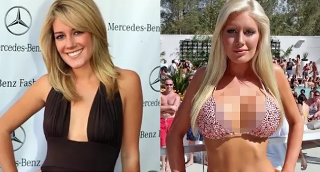 Oplas Seleb Hollywood