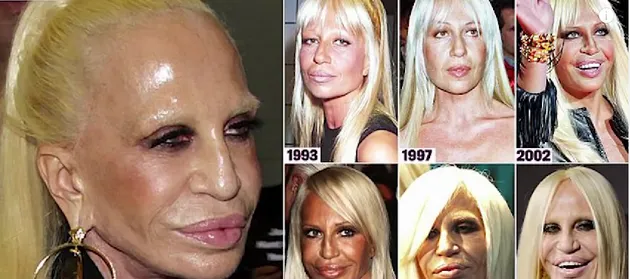 Oplas Seleb Hollywood