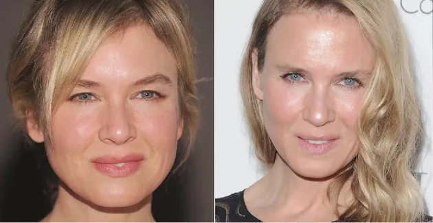 Oplas Seleb Hollywood