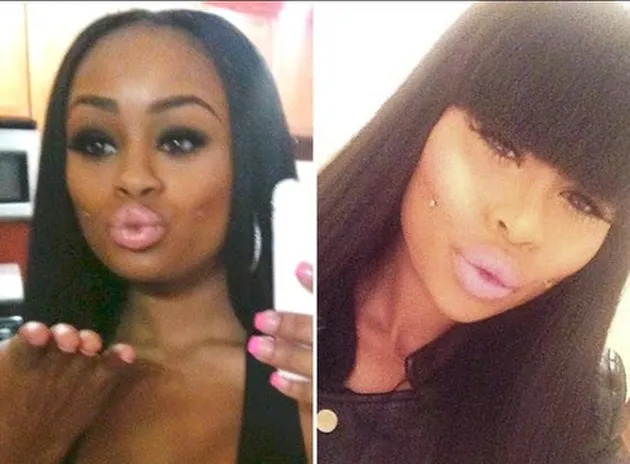 Transformasi Blac Chyna